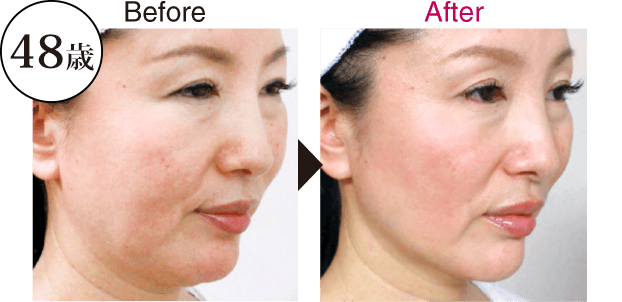 48歳 茂木 利江子さんのBefore Afterの写真