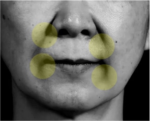 ほうれい線の写真