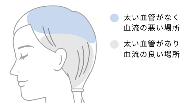 太い血管がなく血流の悪い場所　太い血管があり血流のよい場所