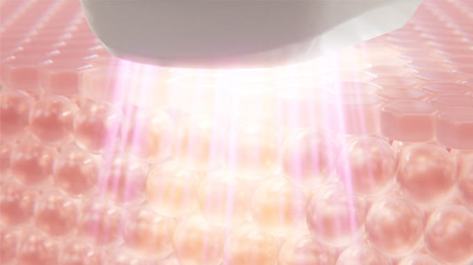 ムダ毛ケアをしながらなめらかな美肌ケア