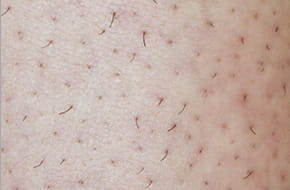 使用前 シェービングのみ