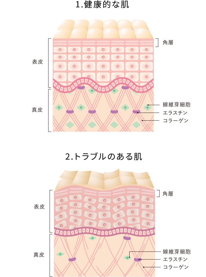 健康的な肌とトラブルのある肌の比較