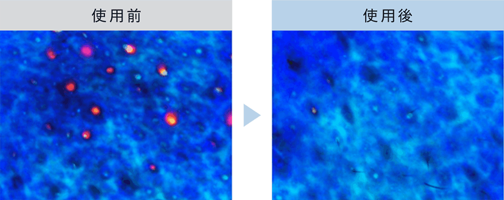 毛穴の奥に潜むポルフィリン汚れもすっきり
