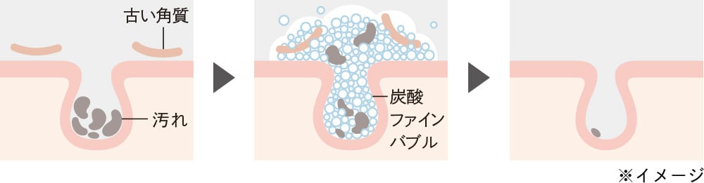 微細な泡が毛穴に入り込み、汚れやくすみを優しく落とす