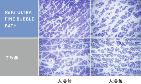 余分な角質を除去し、全身すこやかな肌へ