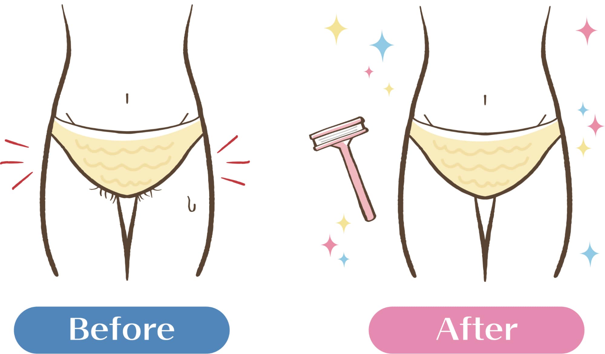 Vライン処理のBeforeとAfter