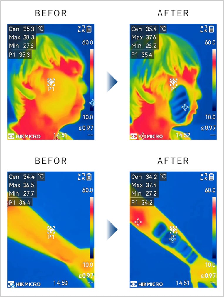照射前後の肌表面の温度比較