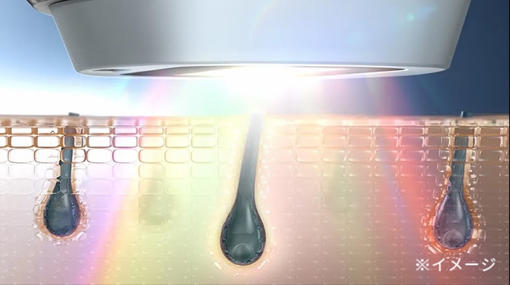 サロンでも使われているIPLを採用