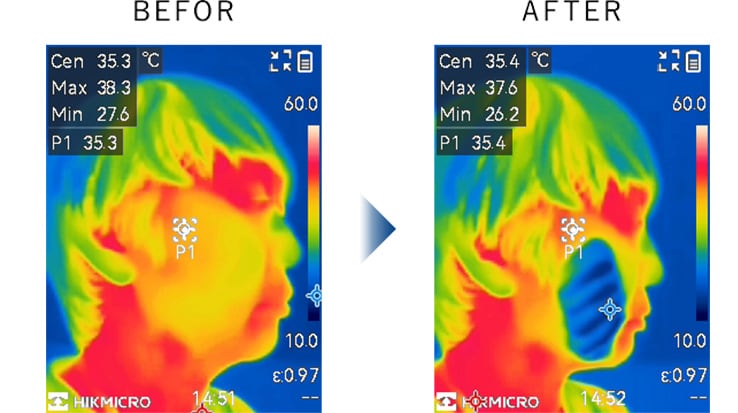 アイストーニングシステム