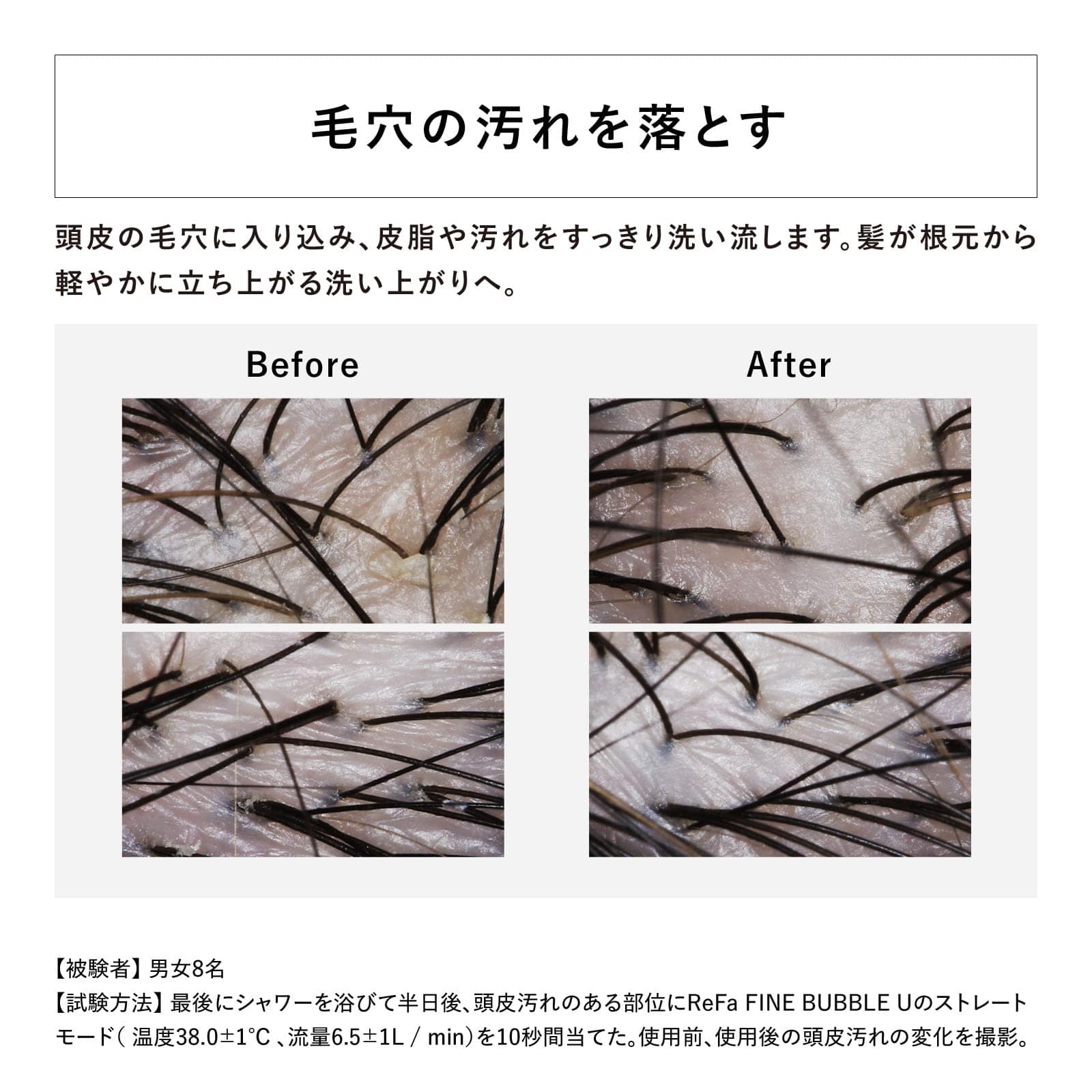 毛穴の汚れを落とす