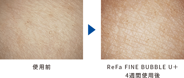 使用前→ReFa FINE BUBBLE U+ 4週間使用後