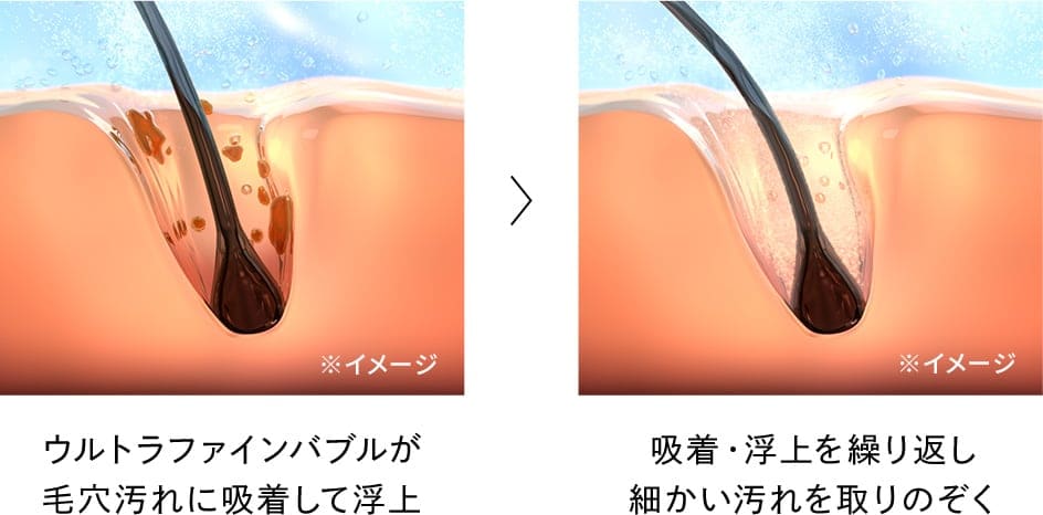 ウルトラファインバブルが毛穴汚れに吸着して浮上、吸着・浮上を繰り返し細かい汚れを取りのぞく
