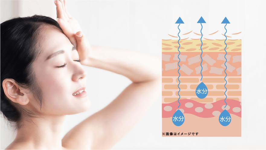 肌から水分が出ていく図