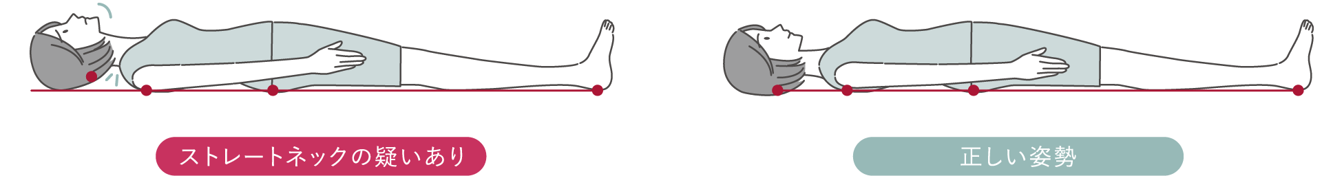 ストレートネック(スマホ首)のセルフチェック診断　仰向けテスト