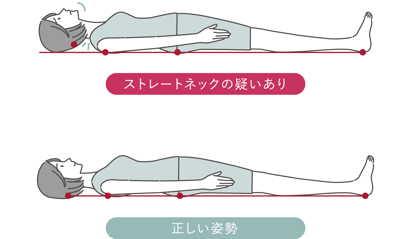 ストレートネック(スマホ首)のセルフチェック診断　仰向けテスト
