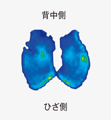 背中側 ひざ側