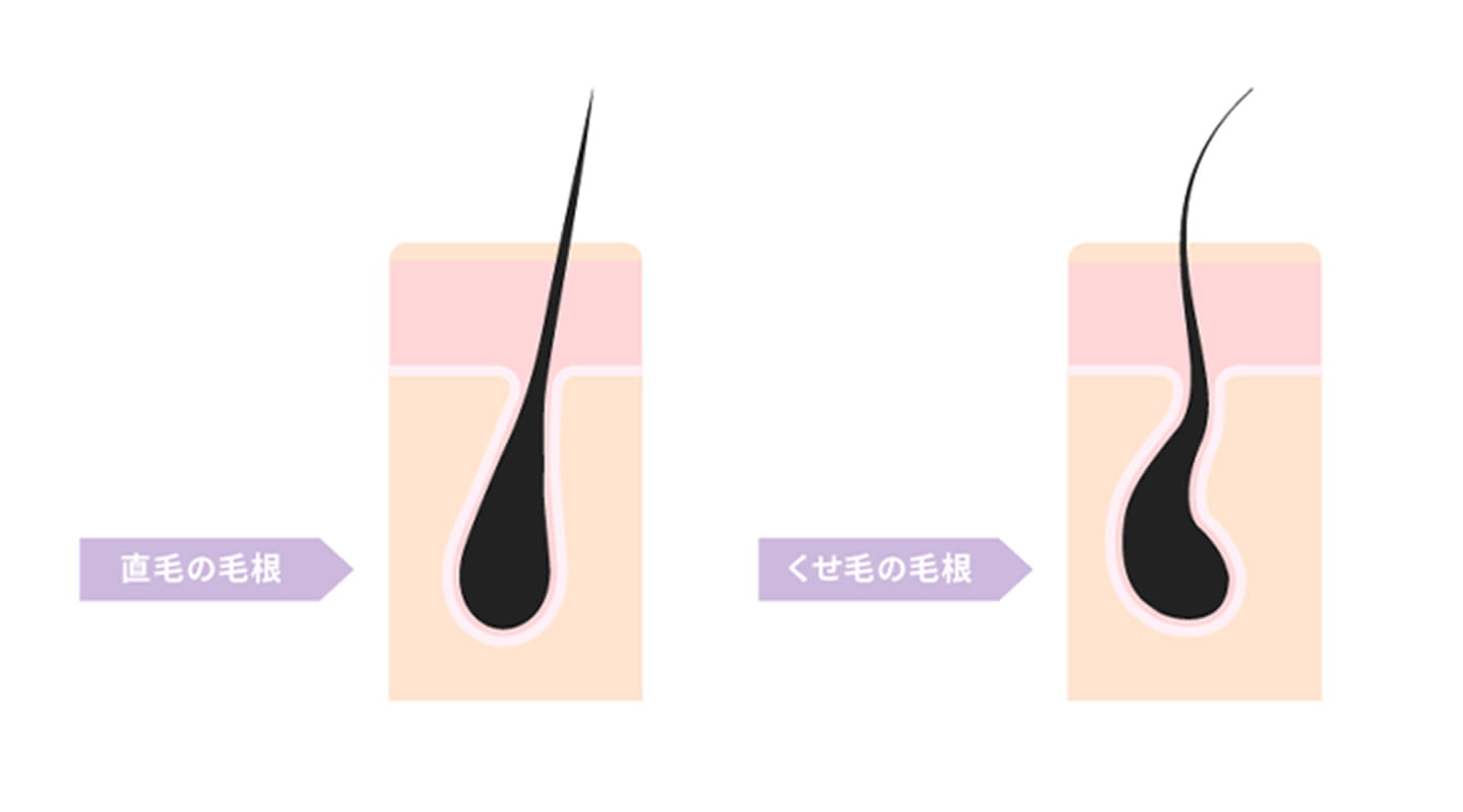もともとクセ毛である