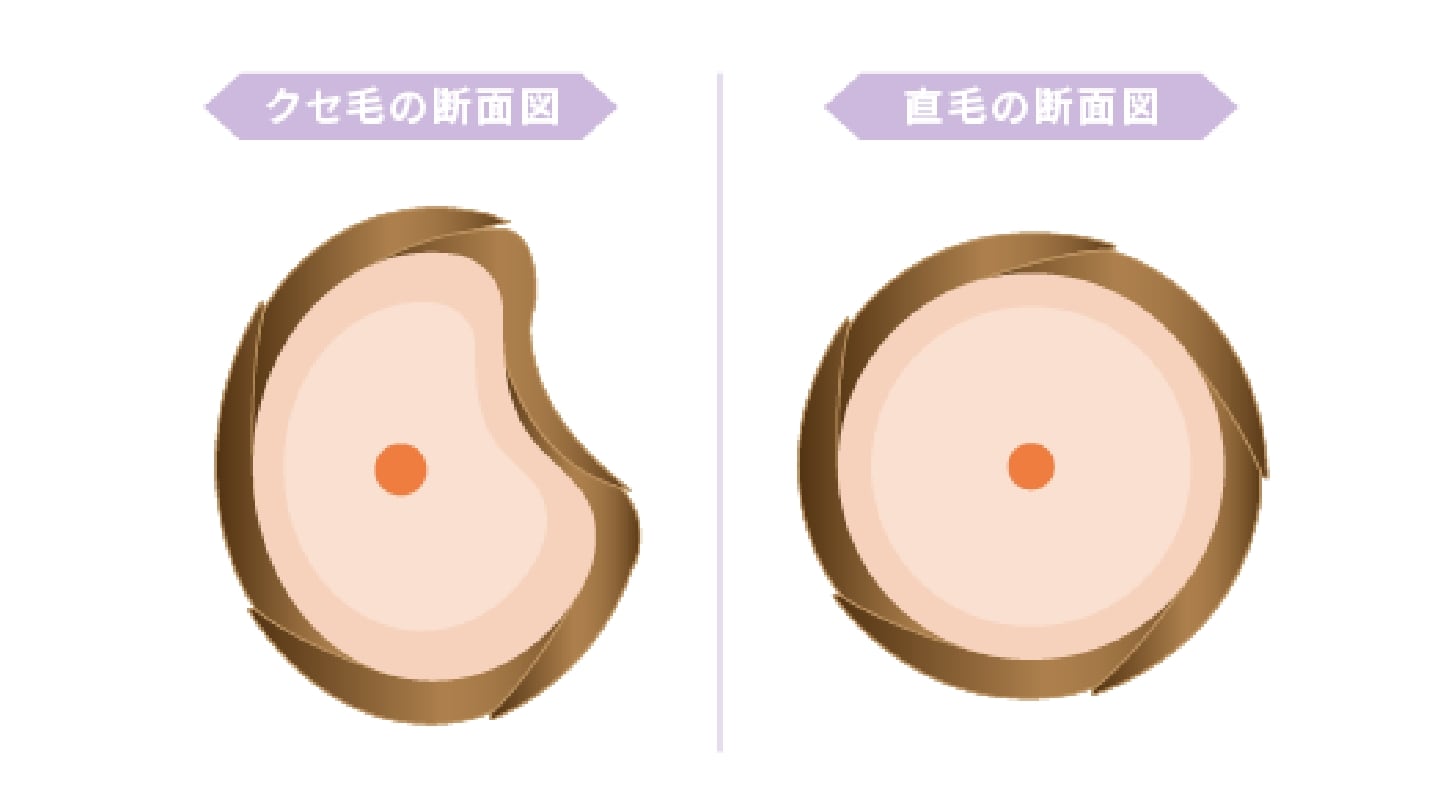 クセ毛の断面図と直毛の断面図