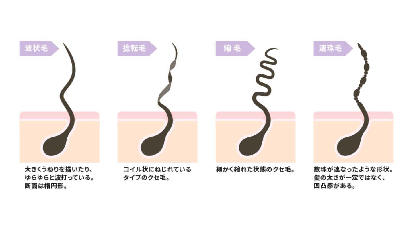 捻転毛はクセ毛の一種!ほかのクセ毛との違いは?