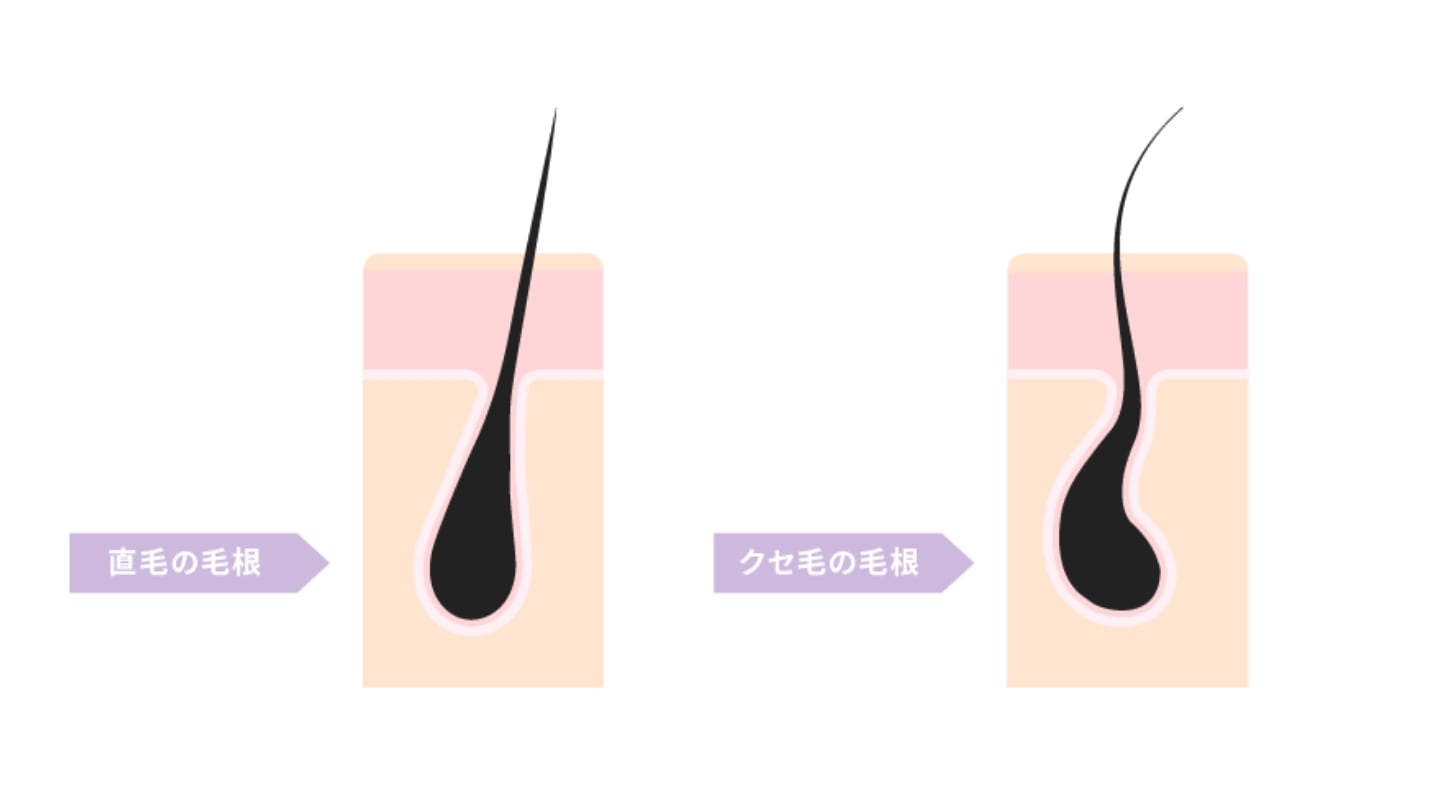 直毛とはまっすぐに生えている髪のこと