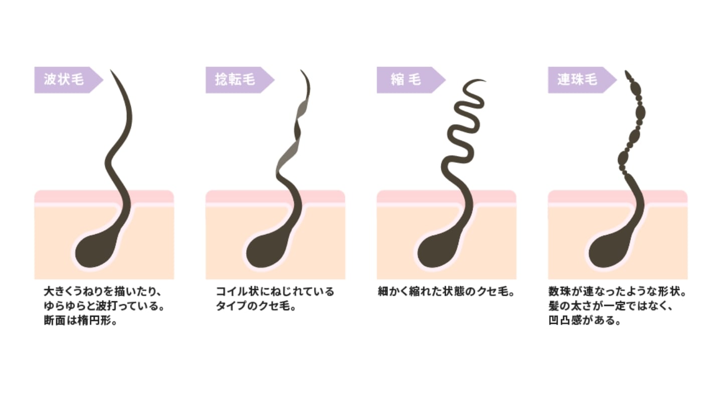 クセ毛には種類がある