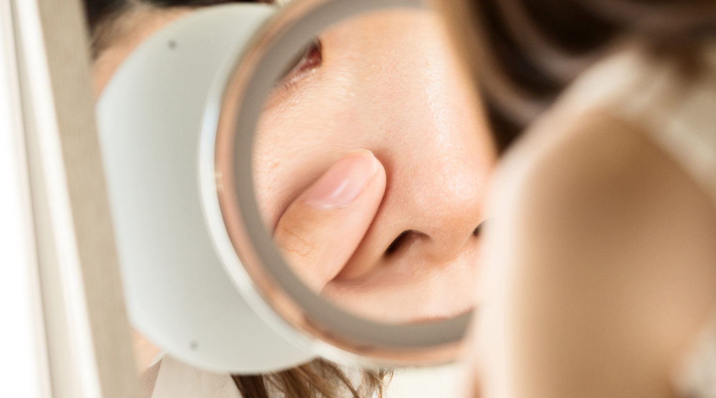 「いちご鼻」とは？