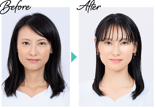 Before→After