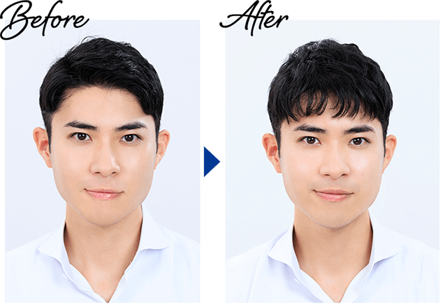 Before→After