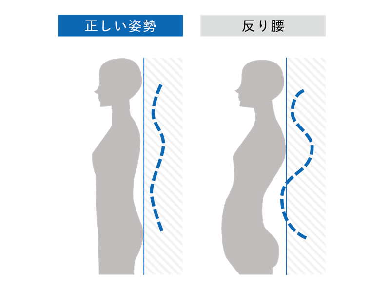 反り腰とは