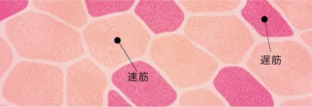 EMSは見た目の変化が現れやすい