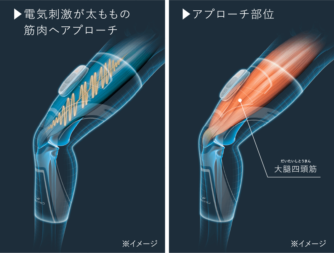 膝のイメージ図